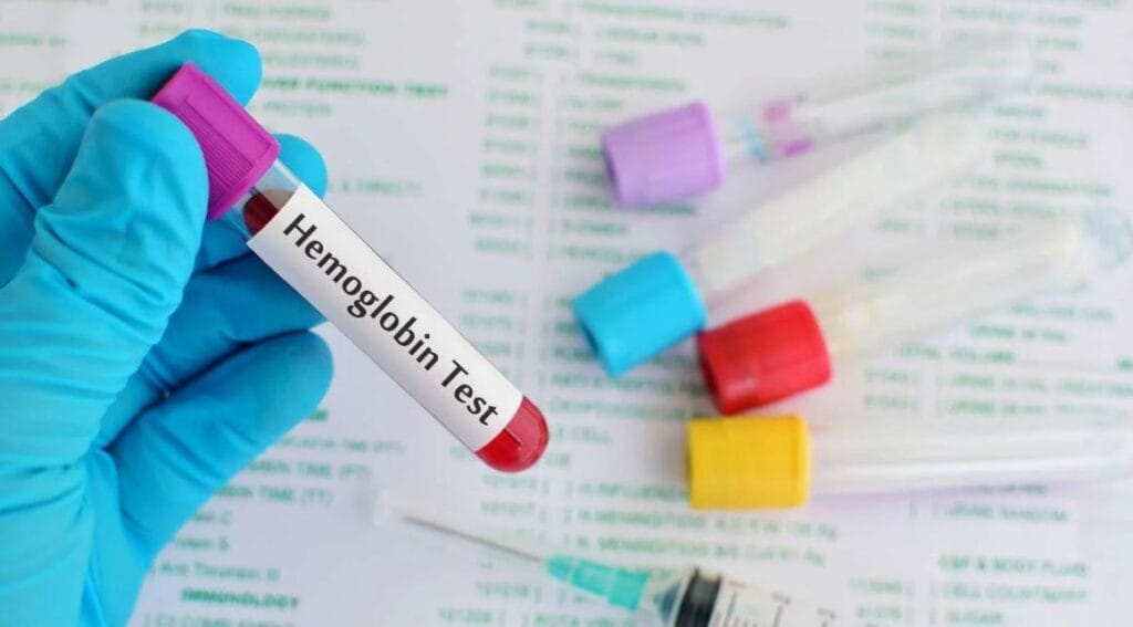 A nurse is performing a blood test for hemoglobin.