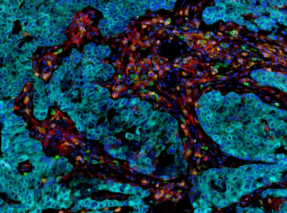 Tissue imaging with multiplex protein staining