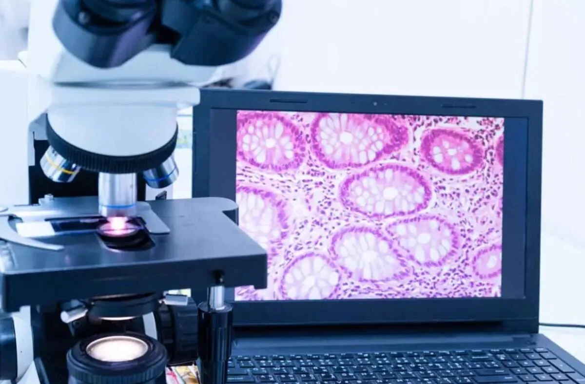Pathologist looking at a sample using a digital microscope