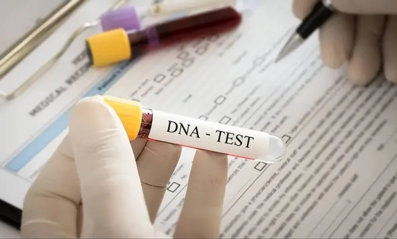 Epithelial samples for PCR analysis for family relatedness