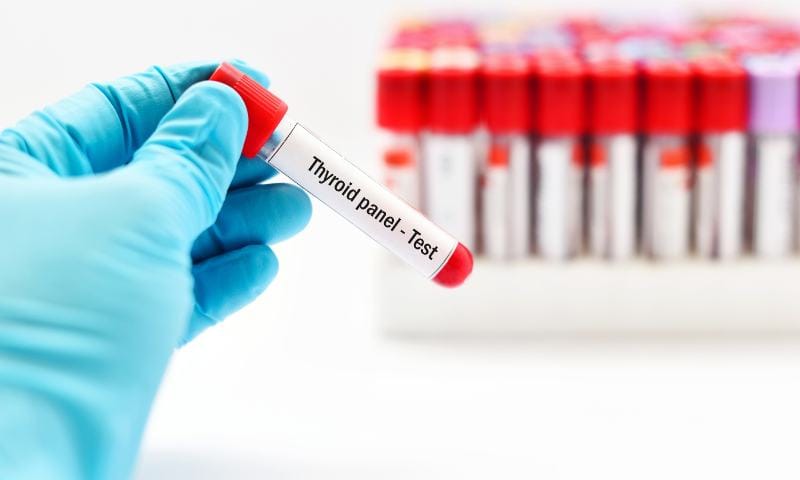 Results of the patient's TSH and T4 analysis