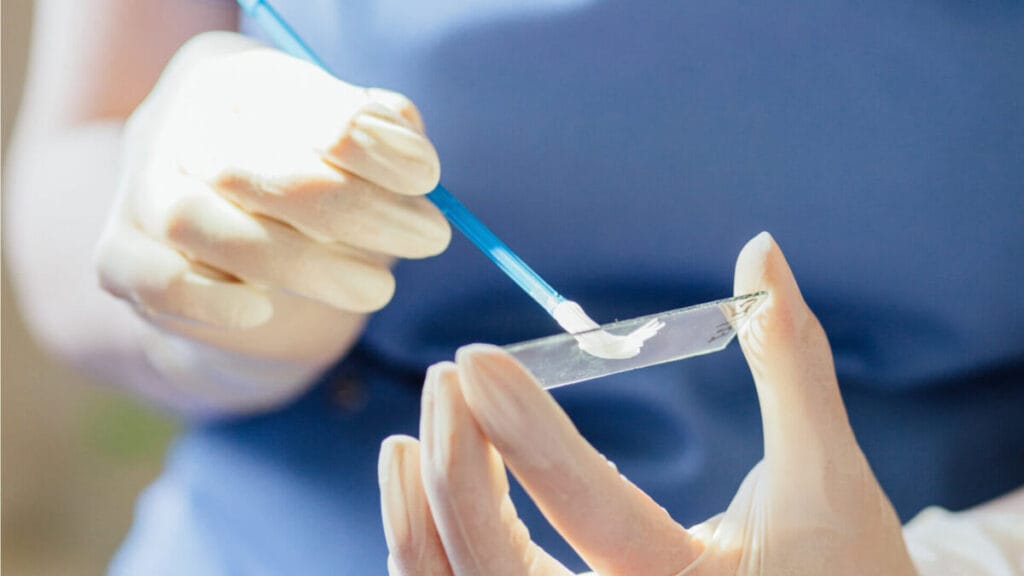 Procedure for taking a smear for sexually transmitted infections in a clinical setting