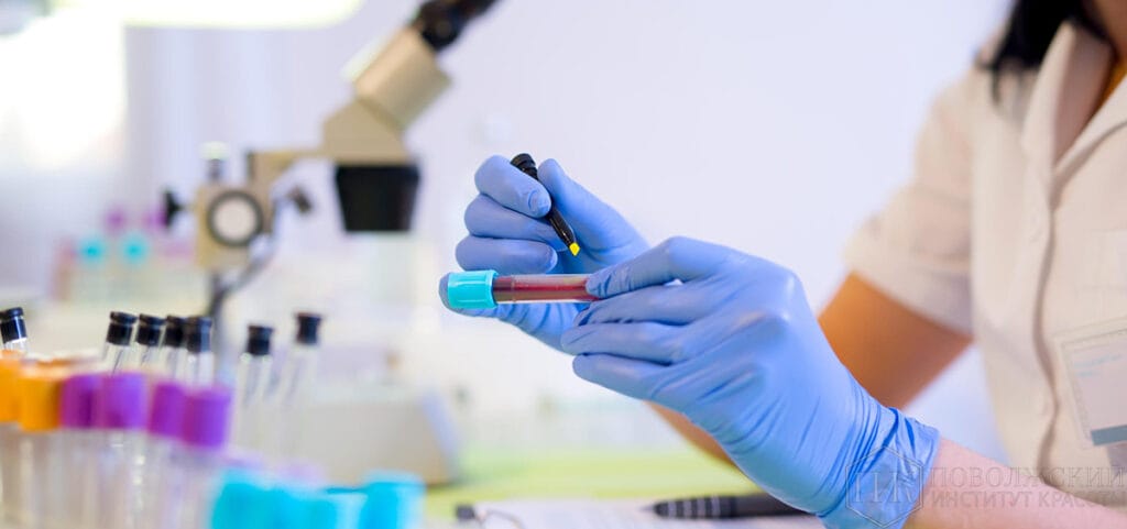 Blood retinol level analysis