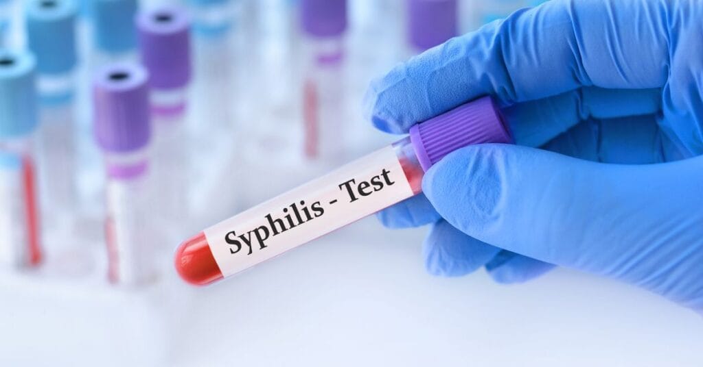 A nurse is taking a blood sample for syphilis in a clinic