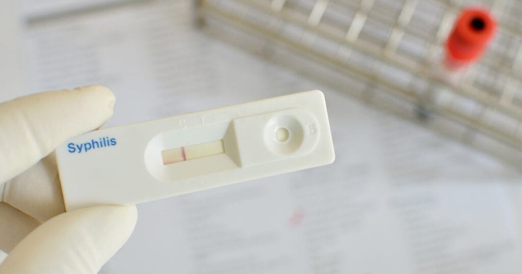 домашний быстрый тест на сифилис