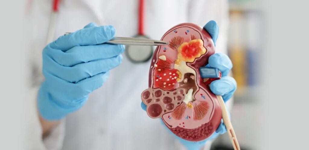 Blood and urine tests to check kidney function