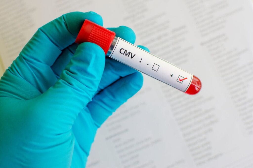 A patient takes a cytomegalovirus test at a clinic