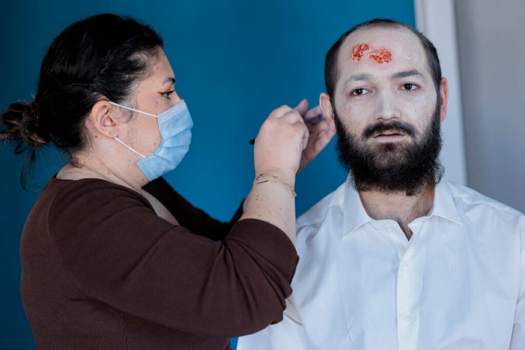 a nurse is taking blood for the RW reaction