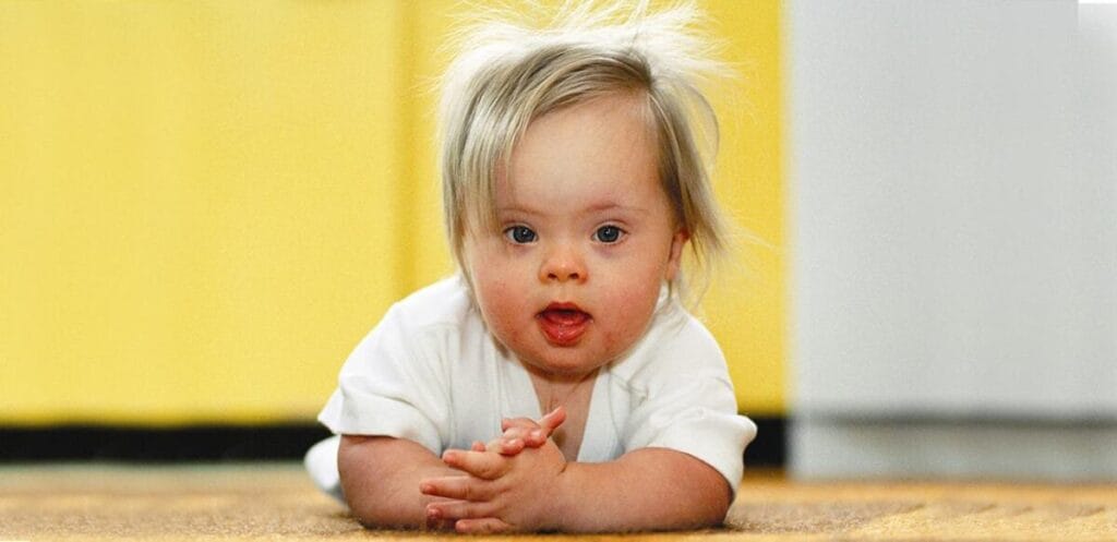 Mother hugs child with Down syndrome