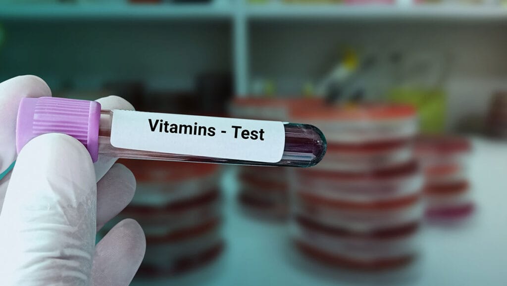 blood test for vitamin status in the laboratory