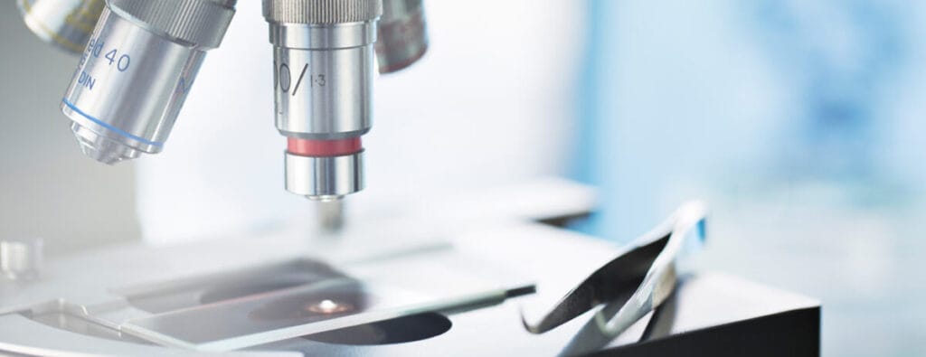 laboratory examination of a urethral swab under a microscope
