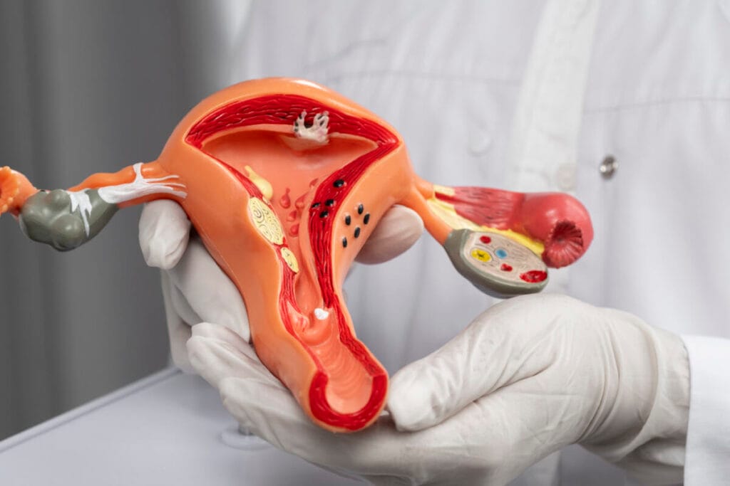 gynecologist consultation for female infections