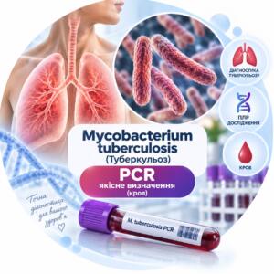 Blood PCR for Mycobacterium tuberculosis