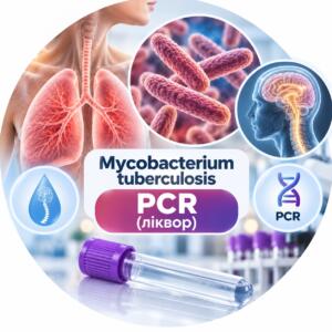 PCR of Mycobacterium tuberculosis in cerebrospinal fluid