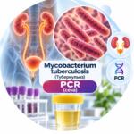 Urine PCR for Mycobacterium tuberculosis