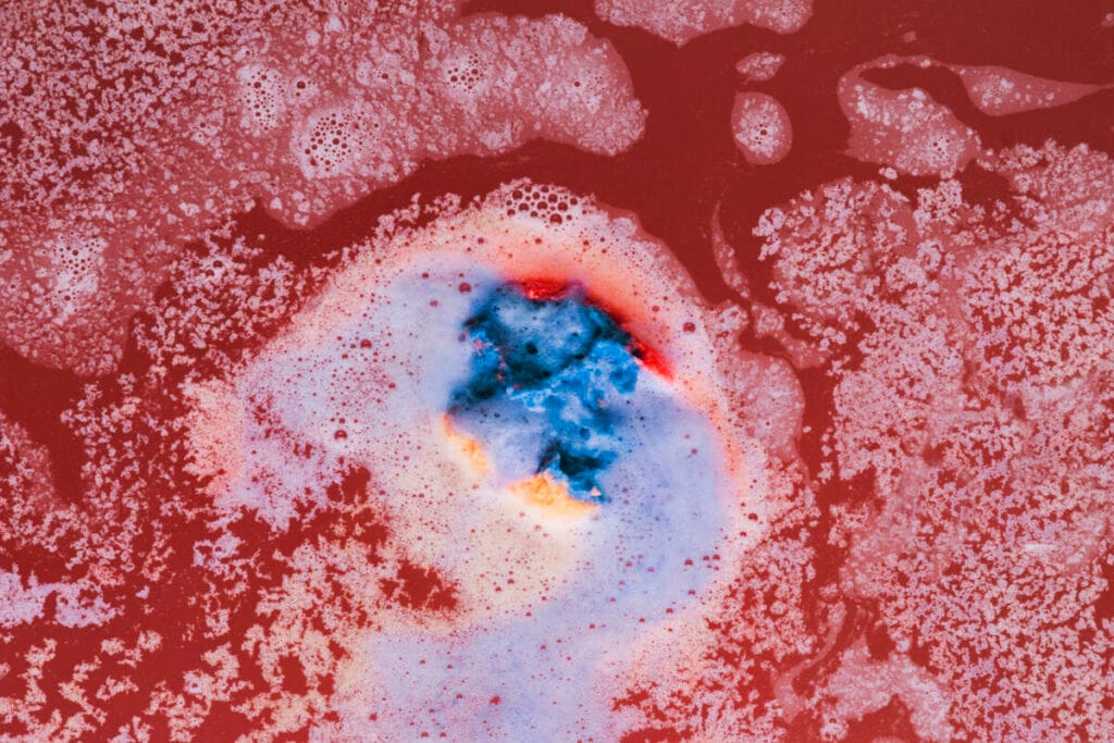 image of chromosomes under a microscope
