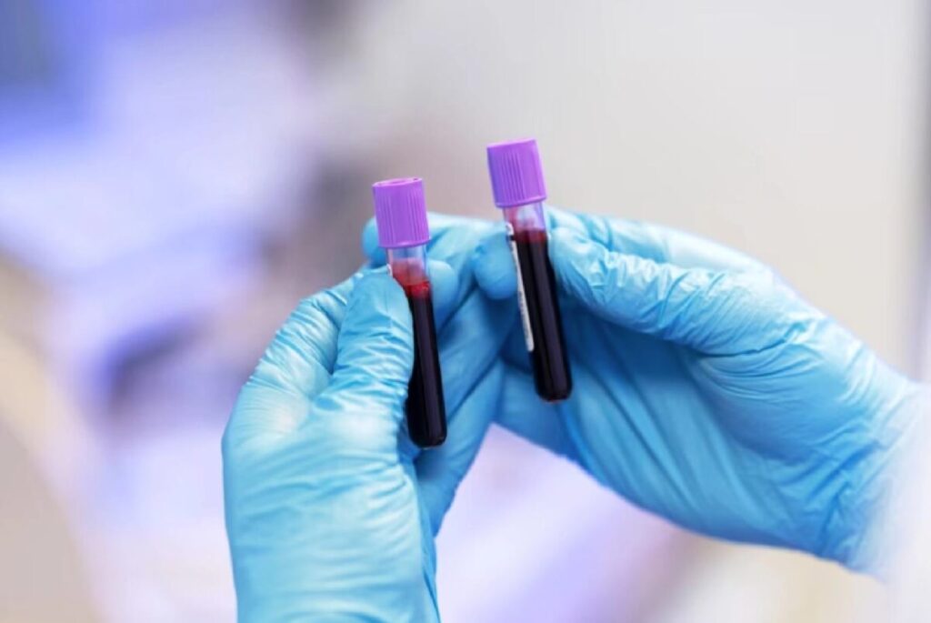 A woman takes a thrombophilia test in a laboratory