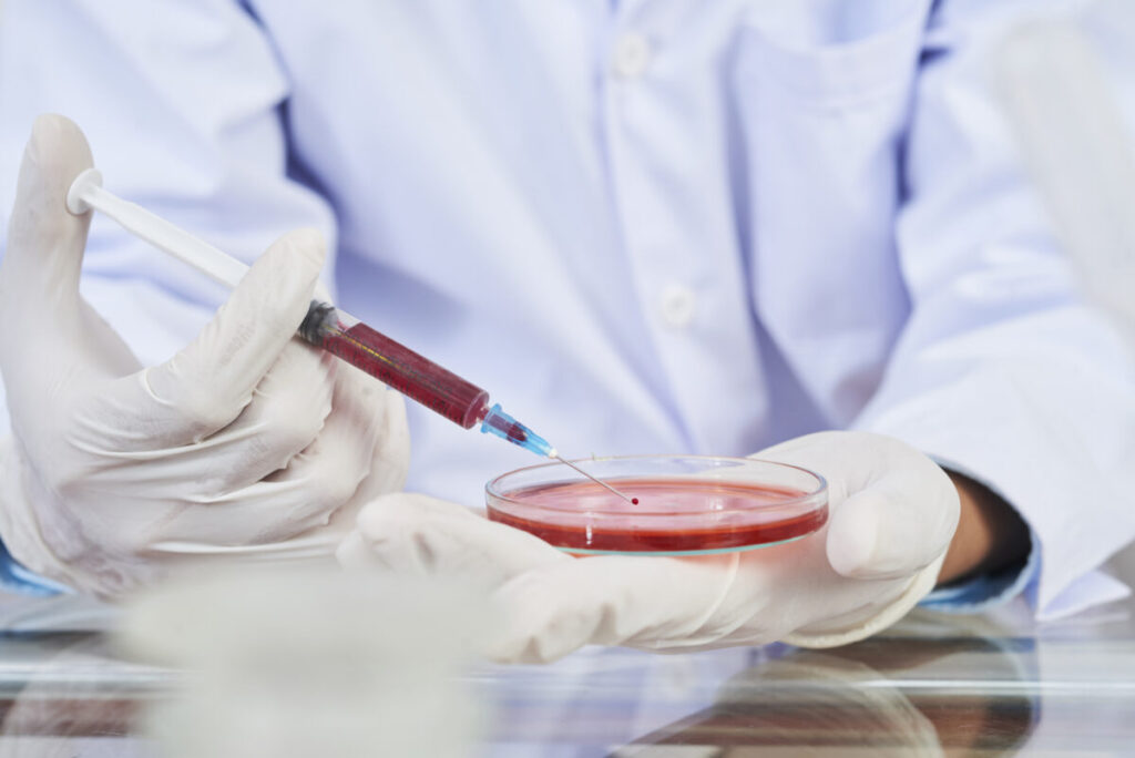Blood test for iron in the laboratory