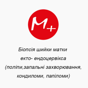 Біопсія шийки матки екто- ендоцервікса (поліпи, запальні захворювання, кондиломи, папіломи)
