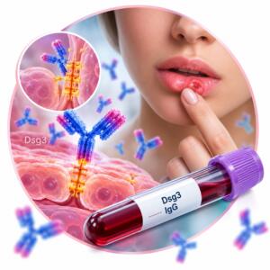 Анализ крови на антитела к десмоглеину-3 Dsg3, IgG — Меди Лаб Плюс