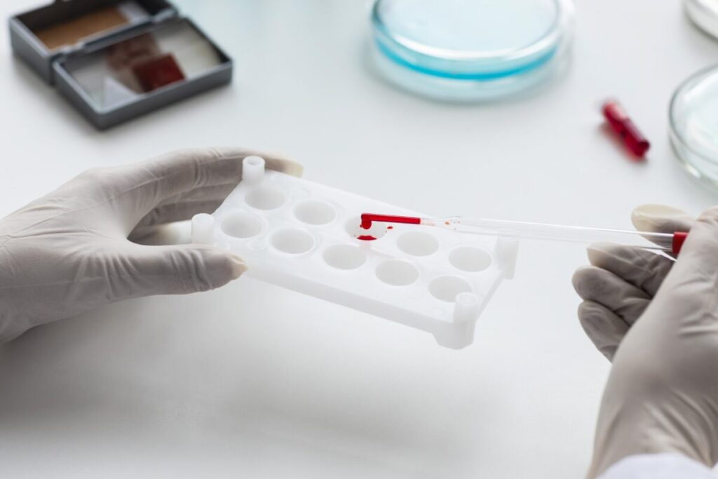 A woman donates blood in a laboratory for analysis of tumor markers