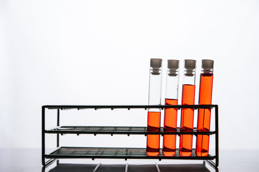 Container with urine for laboratory testing