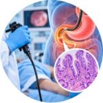 Duodenal biopsy