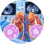 Investigation of cystic formations of the kidney and adrenal glands