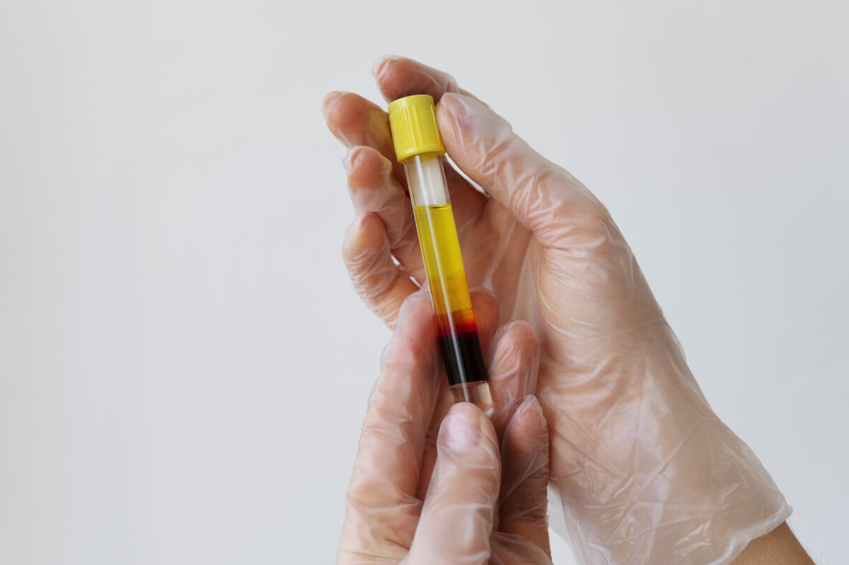 кожные проявления молочной аллергии