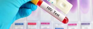 HIV PCR molecular blood diagnostics