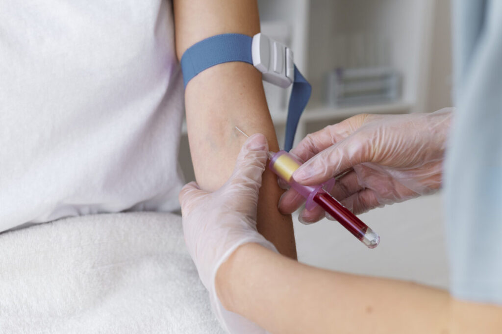blood test for HCG early laboratory diagnosis