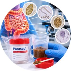 Виявлення кишкових паразитів та їх яєць — Parasep