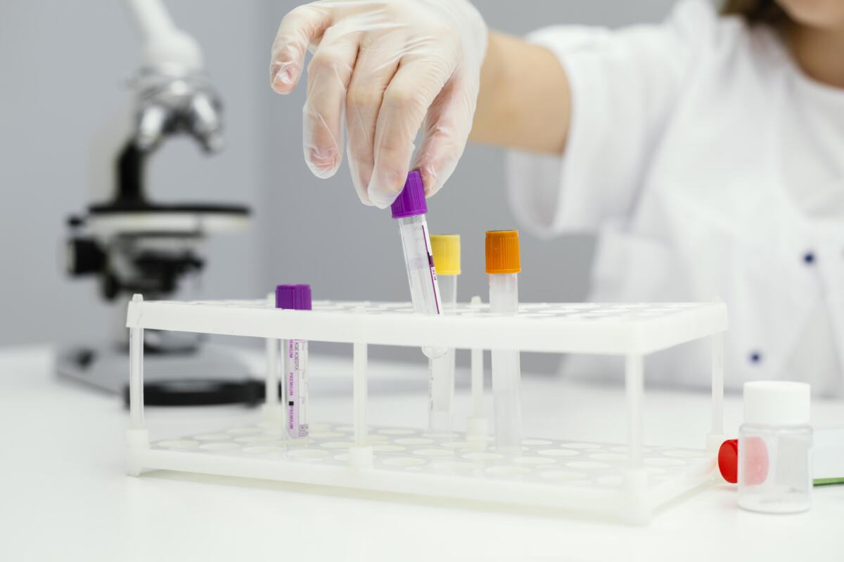 laboratory diagnostics of infections by PCR method