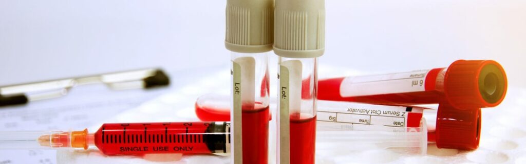 blood test for IgG and IgM antibodies
