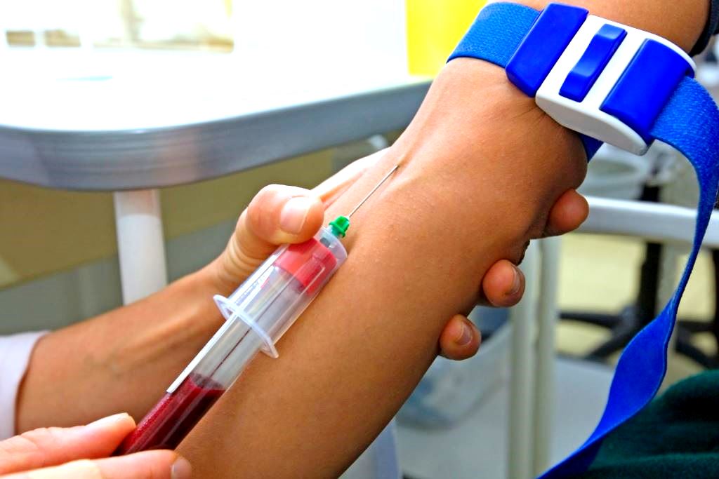 підготовка до лабораторних аналізів крові