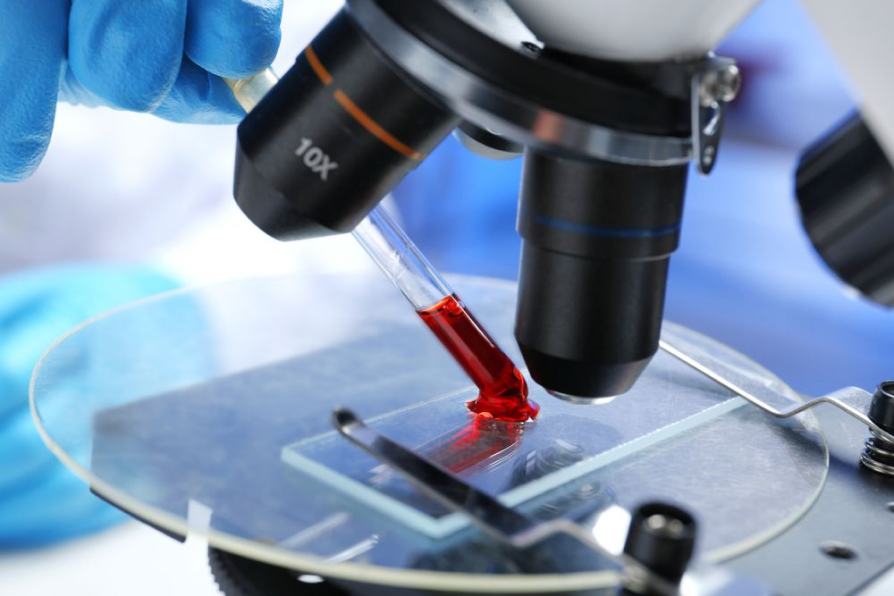 laboratory determination of antibodies in the blood