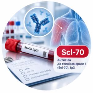 Анализ на антитела к топоизомеразе I (Scl-70), IgG - Меди Лаб Плюс