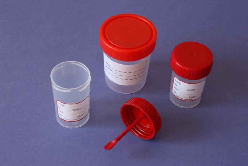 контейнер для аналізу калу та підготовка до лабораторного дослідження