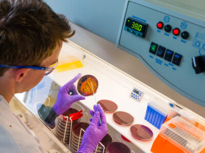 аналіз калу на дисбіоз та лабораторна оцінка мікробіоти кишківника