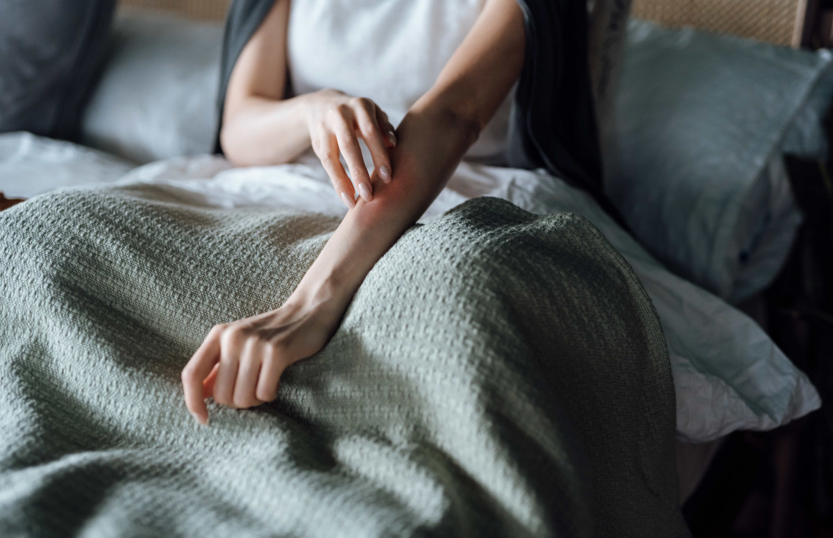 контактна алергія висип на шкірі після дотику до алергену