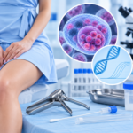 Chlamydia trachomatis (хламідіоз) — PCR-кількісне визначення у зішкрібі