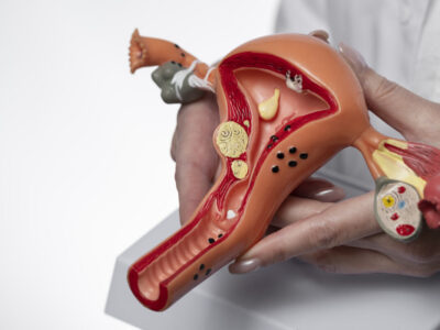 маркери раку матки та сучасна діагностика гінекологічних захворювань