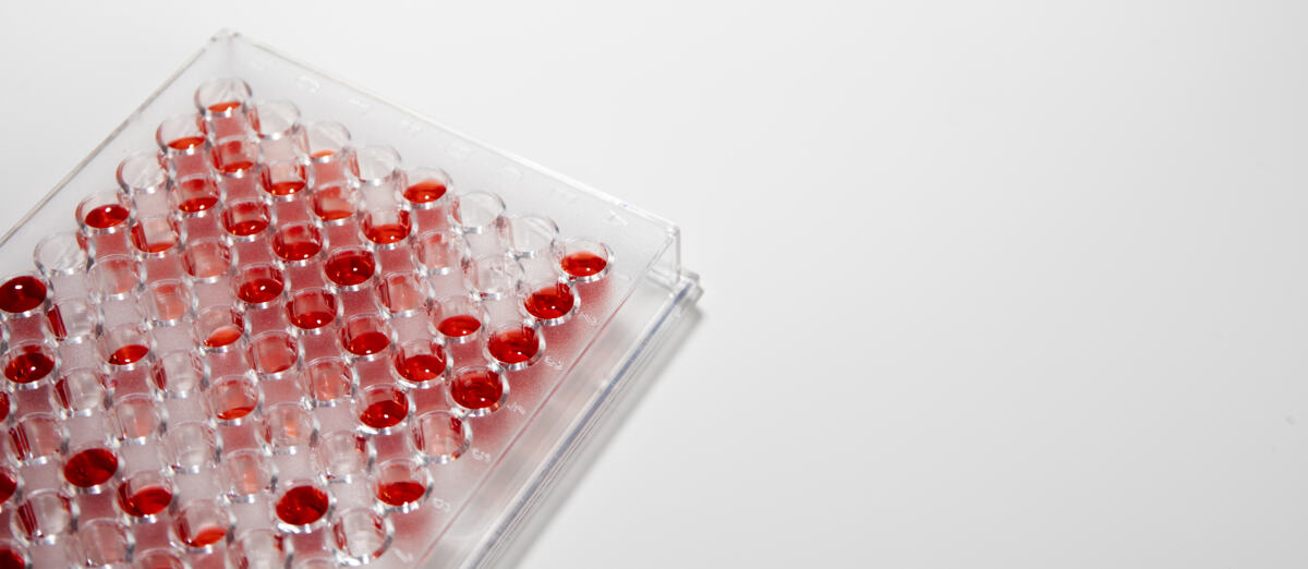 результаты ER и PR при анализе на гормонозависимый рак