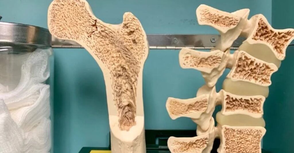 bone metabolism and bone health