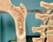 bone metabolism and bone health