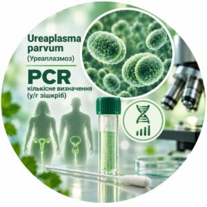 Ureaplasma parvum — кількісне PCR-визначення у/г зішкріб