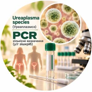Ureaplasma species — кількісне PCR-визначення у/г зішкріб
