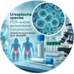Medical illustration for Ureaplasma species analysis with images of microorganisms, test tubes and human silhouettes