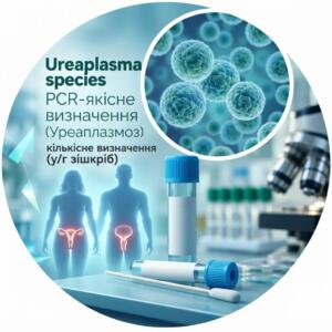 Медична ілюстрація для аналізу Ureaplasma species із зображенням мікроорганізмів, пробірок та силуетів людини