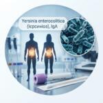 Реалістична медична інфографіка для аналізу на антитіла IgA до Yersinia enterocolitica (ієрсиніоз) із зображенням бактерій та пробірки з біоматеріалом